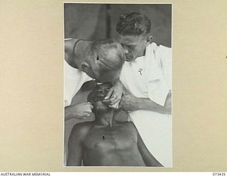 ALEXISHAFEN, NEW GUINEA. 1944-05-22. WX17085 CAPTAIN E.W. JONES (1), DENTAL OFFICER AT C SECTION, 2/5TH DENTAL UNIT EXTRACTING A TOOTH FROM TULEI (3), OF THE PAPUAN INFANTRY BATTALION. HE IS ..