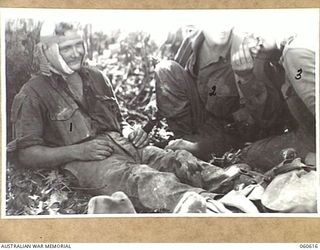 SATTELBERG AREA, NEW GUINEA. 1943-11-17. SX15180 PRIVATE S. T. GALVIN OF PETERBOROUGH, SA, AND OF THE 2/48TH. AUSTRALIAN INFANTRY BATTALION, WOUNDED IN THE ASSAULT ON SATTELBERG, WAITING FOR ..