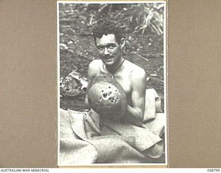 DUMPU, NEW GUINEA, 1943-10-15. VX75884 PRIVATE K. KILPATRICK, A PATIENT OF THE 2/6TH AUSTRALIAN FIELD AMBULANCE SHOWING HIS TIN HAT WHICH WAS RIDDLED BY FRAGMENTS OF A JAPANESE HAND GRENADE