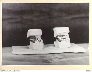 TOROKINA, BOUGAINVILLE, 1945-06-21. MODELS OF DENTURES. SUBJECT, THE TREATMENT OF MALOCCLUSION. PHOTOGRAPH TAKEN AT REQUEST OF DR. WORNER, VISITING AUSTRALIAN SCIENTIST TO HQ 4 BASE SUB-AREA