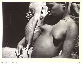 SIPILANGAN, NEW BRITAIN, 1945-07-27. AN EMANCIATED PICCANINNY IN MOTHER'S ARMS AT THE AUSTRALIAN NEW GUINEA ADMINISTRATIVE UNIT REFUGEE CAMP IN THE WIDE BAY AREA. THEY ARE REFUGEES FROM THE ..