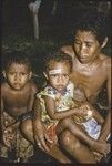 Child with bandaged forehead sits on a woman's lap, eating coconut