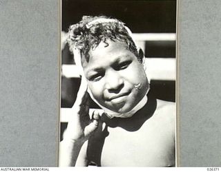 NEW GUINEA. 1942-08. THIS YOUNG PAPUA BOY HAS HAD A SERIOUS BOIL INFECTION OF THE FACE AND HAS BEEN RECEIVING TREATMENT AT THE HOSPITAL OF THE NATIVE MEDICAL SERVICES
