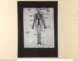 LAE AREA, NEW GUINEA, 1945-08-03. A "PIDGIN" ENGLISH CHART USED FOR THE INSTRUCTION OF NATIVE REGIMENTAL AID POST ORDERLIES. THE PHOTOGRAPH WAS MADE AT THE REQUEST OF HEADQUARTERS AUSTRALIAN NEW ..
