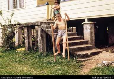 Matt on stilts, Paton Memorial Hospital