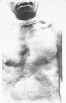 Man showing scarification? on chest, New Guinea?, c1924 to ?