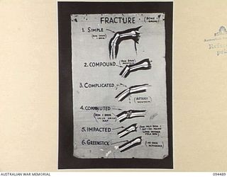 LAE AREA, NEW GUINEA, 1945-08-03. A "PIDGIN" ENGLISH CHART USED FOR THE INSTRUCTION OF NATIVE REGIMENTAL AID POST ORDERLIES. THE PHOTOGRAPH WAS MADE AT THE REQUEST OF HEADQUARTERS AUSTRALIAN NEW ..
