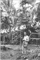 Ninth General Hospital. World War II. James Scott, MD at Trobriand Island.