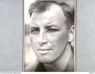 GRAFTON, NSW. 1943-04. BLISTER SUSTAINED BY ARMY PERSONNEL TAKING PART IN CHEMICAL WARFARE EXPERIMENTS NEAR LAKE HIAWATHA. THE PERSONNEL WERE ACTING AS HUMAN "GUINEA PIGS" AND ENTERED AN AREA THAT ..