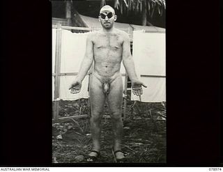 Lae, New Guinea. 1945-02-10. A naked patient wearing eye protectors at 2/7th Australian General Hospital (skin ward). He is suffering from Type (2) - R Tropical Lichenoid Dermatosis