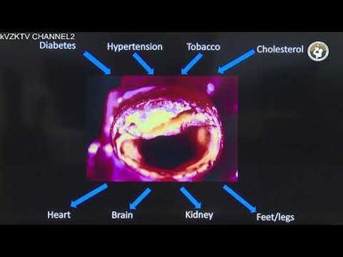 KVZK TV Live Stream CH2