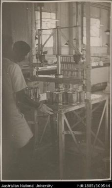 Cutting fingers, Pineapple Cannery