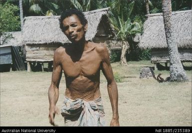 A Papua New Guinean villager suffering due to drought