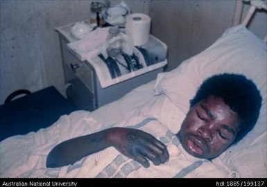 Girl with septicaemia, Asele, Paton Memorial Hospital