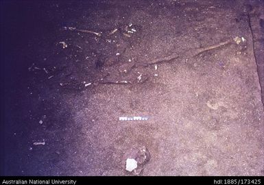 SAC/I, burial 2 and skull of burial 3