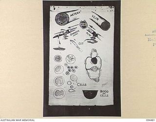 LAE AREA, NEW GUINEA, 1945-08-03. A "PIDGIN" ENGLISH CHART USED FOR THE INSTRUCTION OF NATIVE REGIMENTAL AID POST ORDERLIES. THE PHOTOGRAPH WAS MADE AT THE REQUEST OF HEADQUARTERS AUSTRALIAN NEW ..