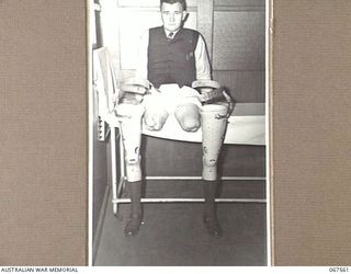SYDNEY, NSW. 1944-07-13. MR. C. KAY, WHO LOST HIS LEGS IN NEW GUINEA, SHOWS HIS DOUBLE AMPUTATION ABOVE THE KNEES AND THE ARTIFICIAL LIMBS SUPPLIED AND FITTED BY THE REPATRIATION ARTIFICIAL LIMB ..