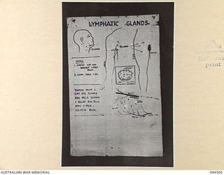 LAE AREA, NEW GUINEA, 1945-08-03. A "PIDGIN" ENGLISH CHART USED FOR THE INSTRUCTION OF NATIVE REGIMENTAL AID POST ORDERLIES. THE PHOTOGRAPH WAS MADE AT THE REQUEST OF HEADQUARTERS AUSTRALIAN NEW ..