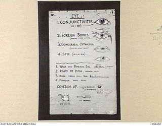 LAE AREA, NEW GUINEA, 1945-08-03. A "PIDGIN" ENGLISH CHART USED FOR THE INSTRUCTION OF NATIVE REGIMENTAL AID POST ORDERLIES. THE PHOTOGRAPH WAS MADE AT THE REQUEST OF HEADQUARTERS AUSTRALIAN NEW ..
