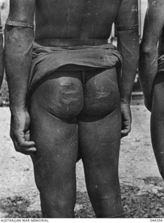 PAPUA NEW GUINEA - PROBABLY NORTHERN PROVINCE, LATE 1942 OR EARLY 1943. VILLAGERS PHOTOGRAPHED AFTER BEING BEATEN (THEY CLAIM) BY MEMBERS OF THE AUSTRALIAN ARMY. (PHOTOS LENT FOR COPYING BY HANK ..