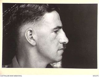 TOROKINA, BOUGAINVILLE, 1945-06-21. TREATMENT OF MALOCCLUSION FOR PATIENT LT R.C. PRICE, AT HQ 4 BASE SUB AREA, BY DENTAL OFFICER, MAJ A.G. ROWELL. PROFILE VIEW SHOWING EXCESSIVE BITE CLOSURE ..