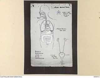 LAE AREA, NEW GUINEA, 1945-08-03. A "PIDGIN" ENGLISH CHART USED FOR THE INSTRUCTION OF NATIVE REGIMENTAL AID POST ORDERLIES. THE PHOTOGRAPH WAS MADE AT THE REQUEST OF HEADQUARTERS AUSTRALIAN NEW ..