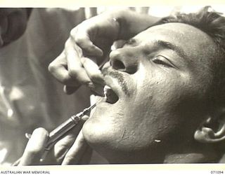 KILIGIA, NEW GUINEA. 1944-03-13. SX11107 CORPORAL K. MITTEN (1), OF THE 2/14TH FIELD REGIMENT, RECEIVING AN INJECTION PRIOR TO TREATMENT "E" SECTION, 2/5TH DENTAL UNIT. THE OBJECT OF THIS DENTAL ..