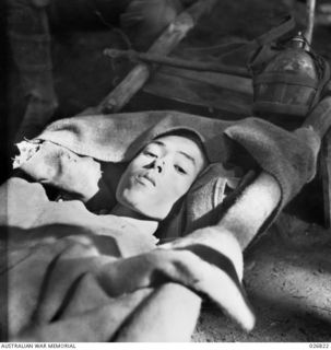 PAPUA, NEW GUINEA. 1942-10. JAPANESE PRISONER CAPTURED NEAR NAURO. HE HAD BEEN OVERWORKED AND WAS NEARLY STARVING WHEN TAKEN PRISONER. HE IS SEEN LYING ON A STRETCHER AFTER BEING CARED FOR BY ..