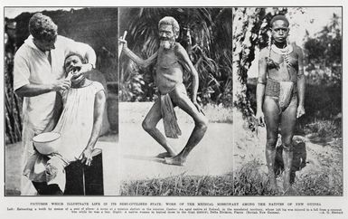Pictures which illustrate life in its semi-civilised state: work of the medical missionary among the natives of New Guinea
