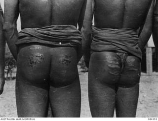 PAPUA NEW GUINEA - PROBABLY NORTHERN PROVINCE, LATE 1942 OR EARLY 1943. VILLAGERS PHOTOGRAPHED AFTER BEING BEATEN (THEY CLAIM) BY MEMBERS OF THE AUSTRALIAN ARMY. (PHOTOS LENT FOR COPYING BY HANK ..