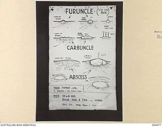 LAE AREA, NEW GUINEA, 1945-08-03. A "PIDGIN" ENGLISH CHART USED FOR THE INSTRUCTION OF NATIVE REGIMENTAL AID POST ORDERLIES. THE PHOTOGRAPH WAS MADE AT THE REQUEST OF HEADQUARTERS AUSTRALIAN NEW ..