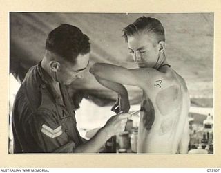ALEXISHAFEN, NEW GUINEA. 1944-05-09. STRANGE PATTERNS APPEAR AS VX63916 CORPORAL H. COURTIER (1), APPLIES TINEA TRIPLE DYE PAINT ON NX156956 PRIVATE N.F. CLARKE (2), AT A REGIMENTAL AID POST OF THE ..