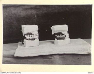 TOROKINA, BOUGAINVILLE, 1945-06-21. TREATMENT OF MALOCCLUSION AT HQ 4 BASE SUB AREA FOR PATIENT SGT A.S. RINGWOOD, BY DENTAL OFFICER, MAJ A.G. ROWELL. MODELS OF DENTURES, RIGHT LATERAL VIEW. 'A', ..