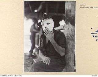 LAE, NEW GUINEA. 1945-06-09. PRIVATE PECK, HAVING A QUIET SMOKE WHILE AWAITING TRANSPORT TO THE HOSPITAL SHIP MANUNDA AFTER RECEIVING TREATMENT AT 2/7 GENERAL HOSPITAL