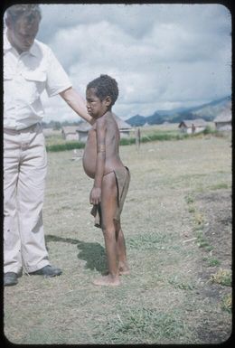 A very sick child who subsequently died of malarial nephritis : Wahgi Valley, Papua New Guinea, 1954-1955 / Terence and Margaret Spencer