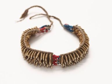 Arm band