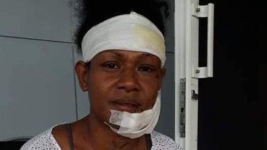 Violent attack on PNG athlete highlights domestic violence epidemic