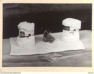 TOROKINA, BOUGAINVILLE, 1945-06-21. CORRECTION OF MALOCCLUSION FOR PATIENT SGT W.T. O'CONNOR, AT HQ 4 BASE SUB AREA, BY DENTAL OFFICER, MAJ A.G. ROWELL. MODELS AND DENTURE, LEFT LATERAL VIEW, 'A', ..