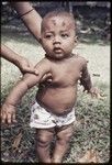 Infant with betel nut paste dabbed on face