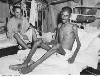 RABAUL, NEW BRITAIN. 1945-10-17. ASMAN KHAN, AN EMACIATED INDIAN, WHO IS RECEIVING TREATMENT AT 105 CASUALTY CLEARING STATION