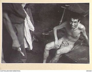 BOUGAINVILLE. 1945-04-06. A JAPANESE PRISONER OF WAR (AN ENGLISH SPEAKING LT) WOUNDED IN ACTION AT SLATER'S KNOLL RECEIVING TREATMENT AT THE REGIMENTAL AID POST, BATTALION HQ 25 INFANTRY BATTALION. ..