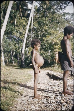 Nutritional dwarfism : Goodenough Island, D'Entrecasteaux Islands, Papua New Guinea, 1956-1958 / Terence and Margaret Spencer