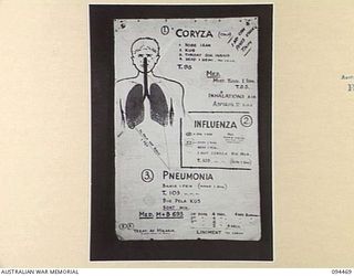 LAE AREA, NEW GUINEA, 1945-08-03. A "PIDGIN" ENGLISH CHART USED FOR THE INSTRUCTION OF NATIVE REGIMENTAL AID POST ORDERLIES. THE PHOTOGRAPH WAS MADE AT THE REQUEST OF HEADQUARTERS AUSTRALIAN NEW ..