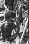 Pig festival, wig ritual, Tsembaga: wig frame is sewn to man's hair