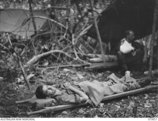 WAITAVALO AREA, WIDE BAY, NEW BRITAIN. 1945-03-16. BATTLE CASUALTIES AT THE 6TH FIELD AMBULANCE, AUSTRALIAN ARMY MEDICAL CORPS DRESSING STATION