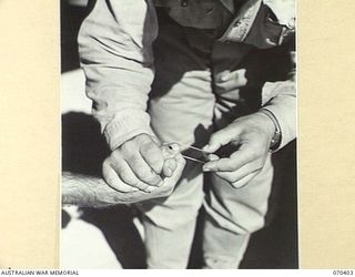 FINSCHHAFEN, NEW GUINEA, 1944-01-31. A BLOOD SAMPLE BEING TAKEN FROM THE THUMB OF NX59305 CORPORAL T. DAVIDSON AT THE 2/3RD CASUALTY CLEARING STATION TO DETERMINE WHETHER THE PATIENT IS SUFFERING ..