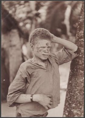 Albino boy at Rowa, Banks Islands, 1906 / J.W. Beattie