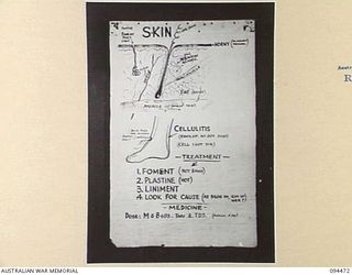 LAE AREA, NEW GUINEA, 1945-08-03. A "PIDGIN" ENGLISH CHART USED FOR THE INSTRUCTION OF NATIVE REGIMENTAL AID POST ORDERLIES. THE PHOTOGRAPH WAS MADE AT THE REQUEST OF HEADQUARTERS AUSTRALIAN NEW ..