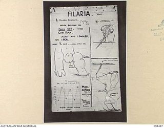 LAE AREA, NEW GUINEA, 1945-08-03. A "PIDGIN" ENGLISH CHART USED FOR THE INSTRUCTION OF NATIVE REGIMENTAL AID POST ORDERLIES. THE PHOTOGRAPH WAS MADE AT THE REQUEST OF HEADQUARTERS AUSTRALIAN NEW ..