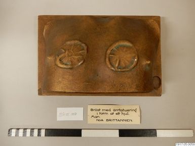 ["bröst, gipsavgjutning"]